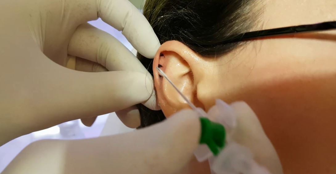Helix Piercing Acıyor mu?