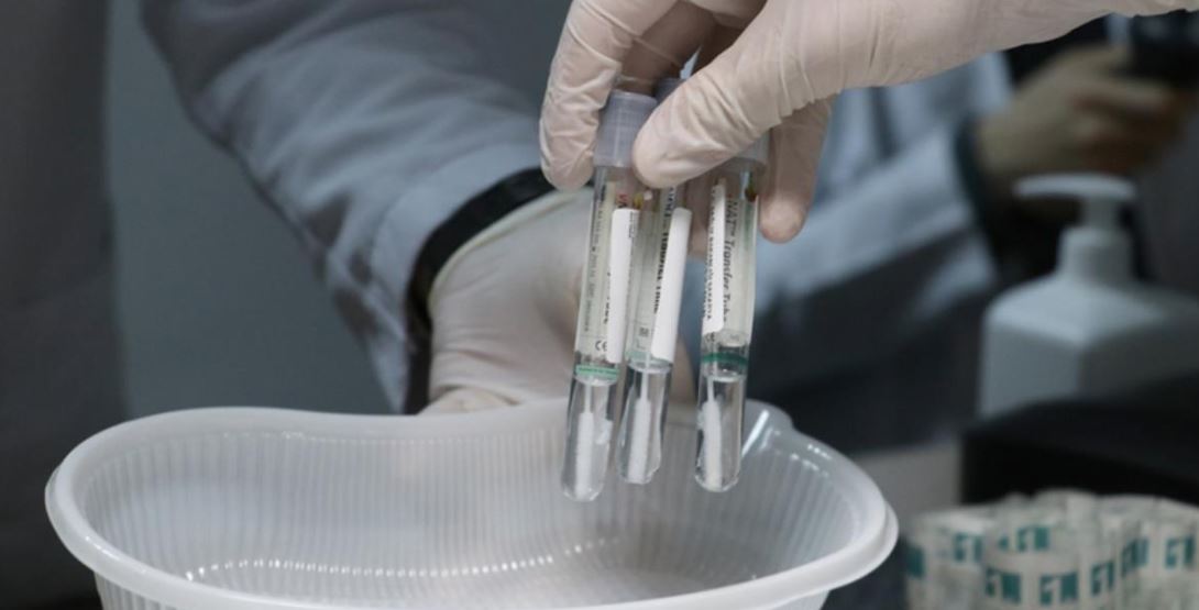 Sağlık Ocakları Pcr Testi Yapıyor mu?