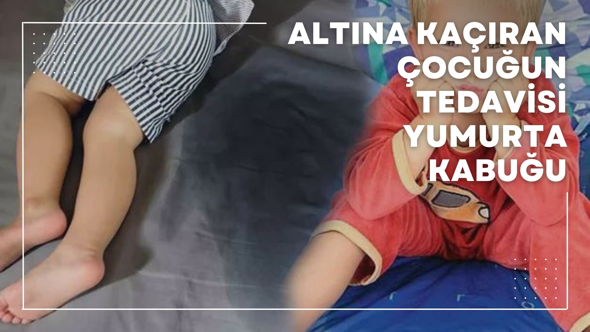 Altına Kaçıran Çocuğun Tedavisi Yumurta Kabuğu