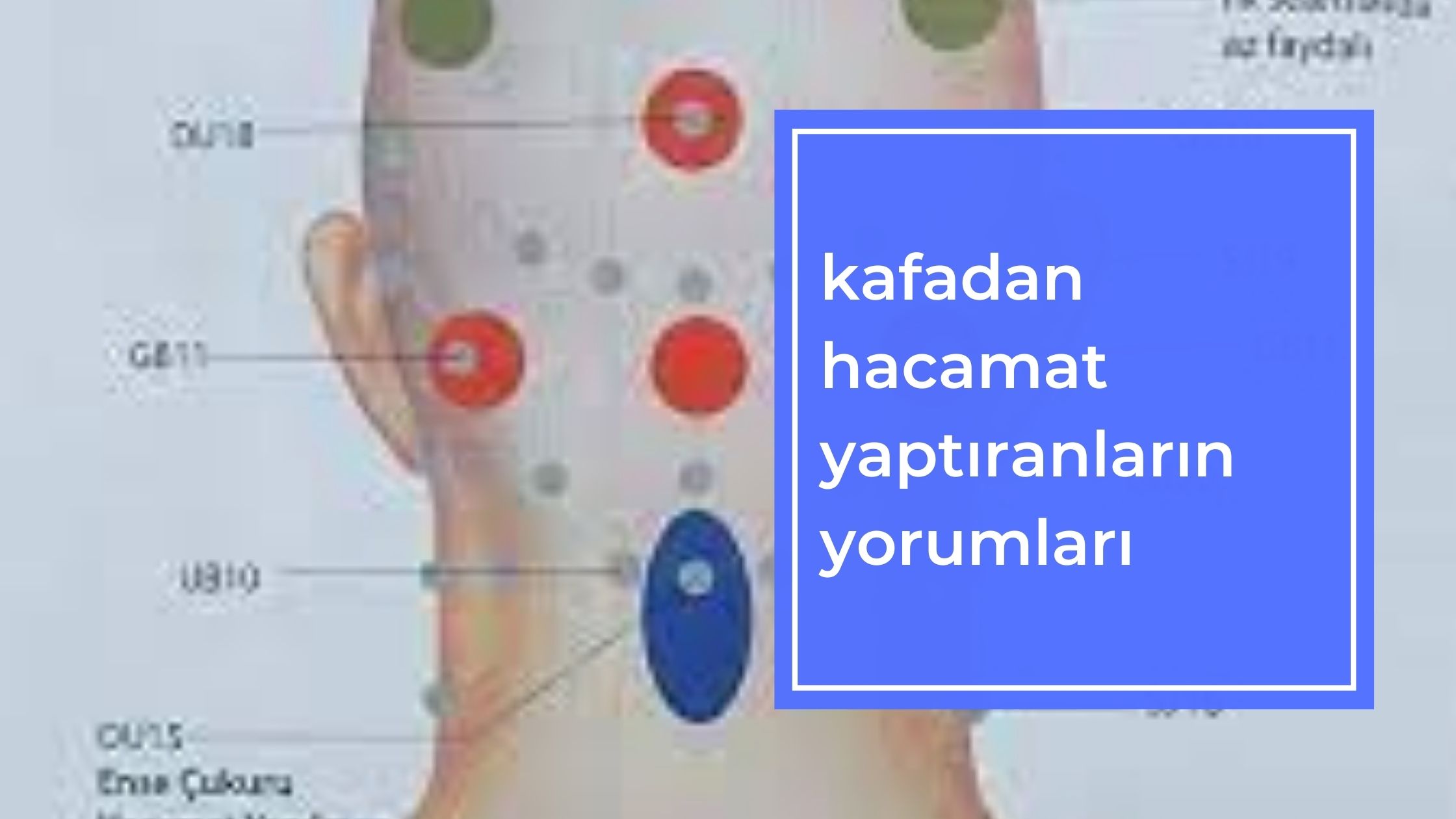 Kafadan Hacamat Yaptıranların Yorumları