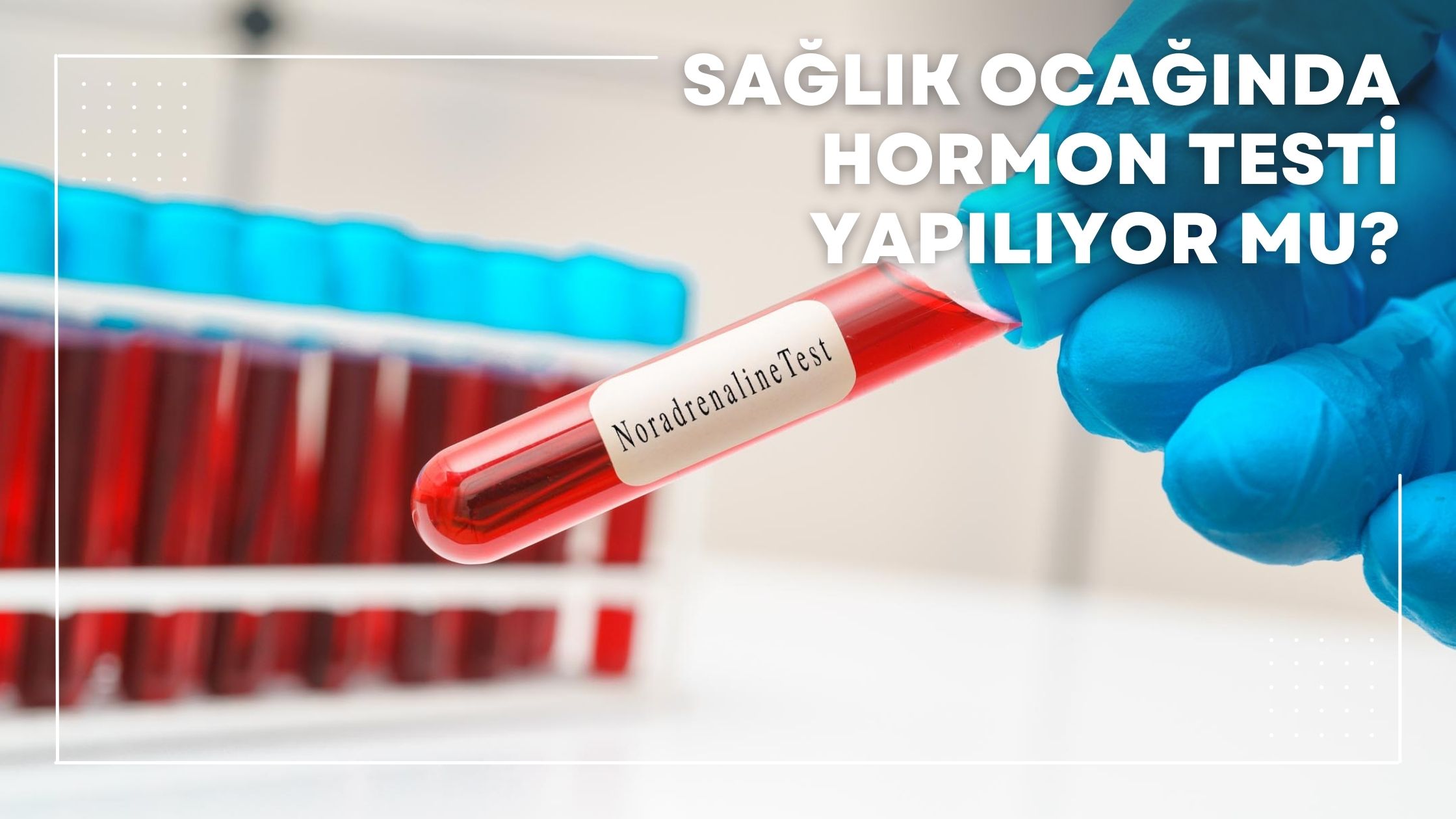 Sağlık Ocağında Hormon Testi Yapılıyor mu?