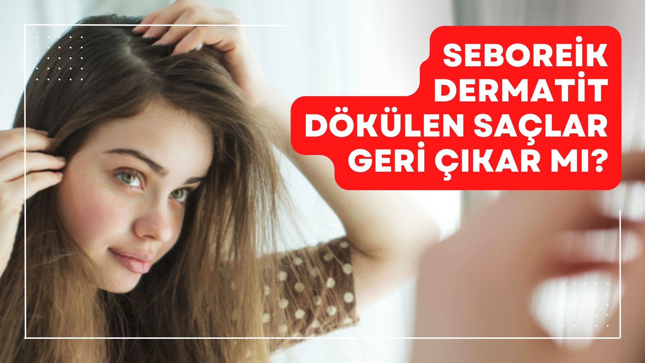 Seboreik Dermatit Dökülen Saçlar Geri Çıkar mı?