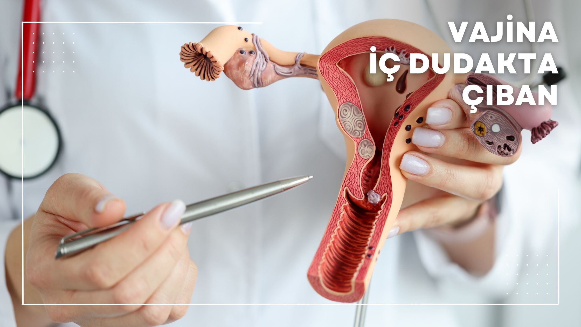 Vajina İç Dudakta Çıban
