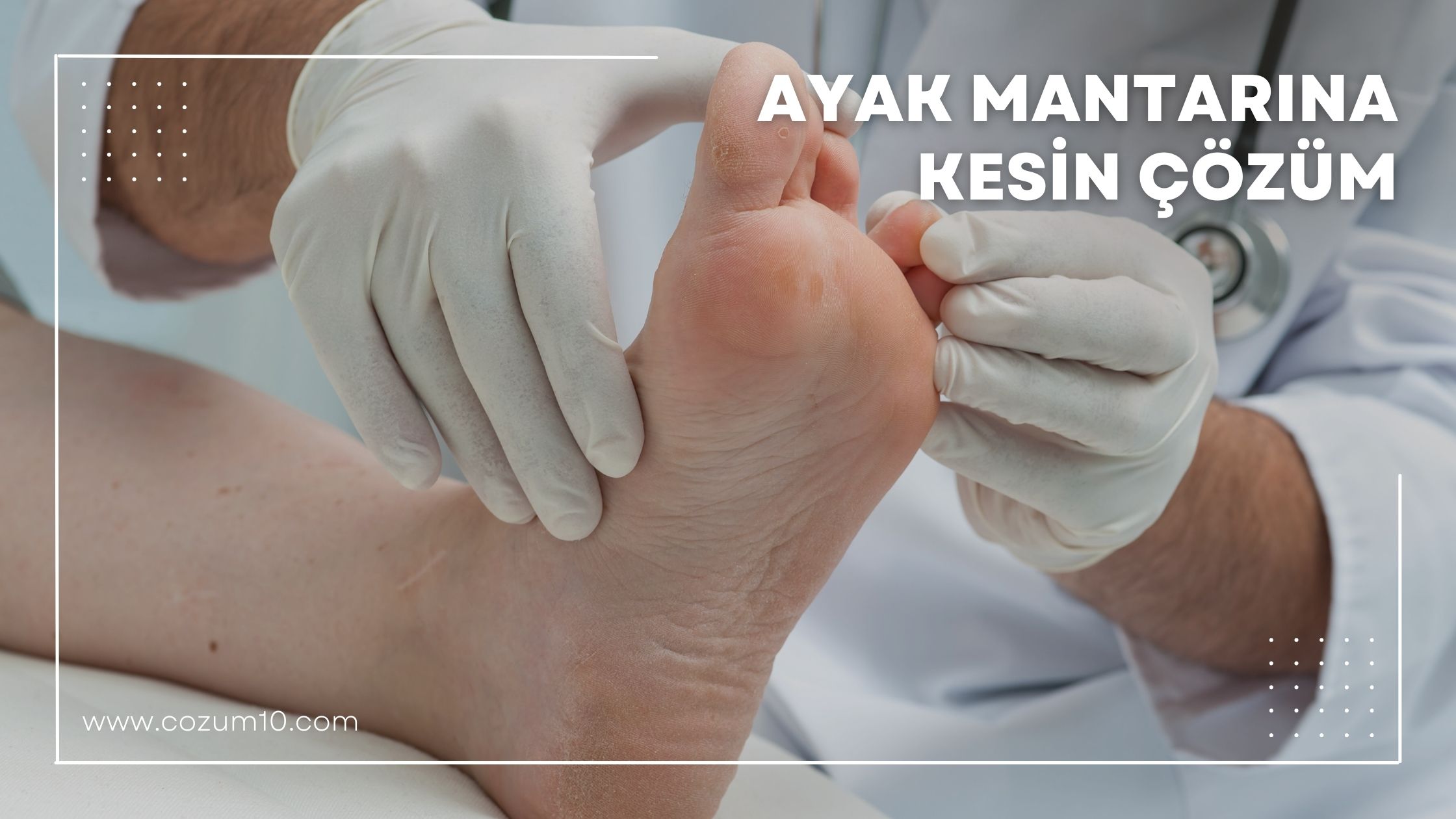 Ayak Mantarına Kesin Çözüm