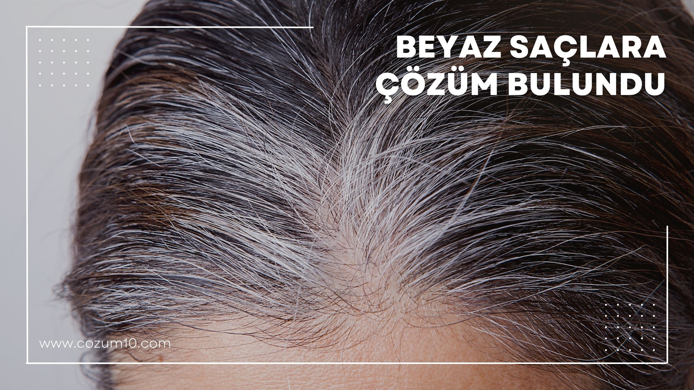 Beyaz Saçlara Çözüm Bulundu