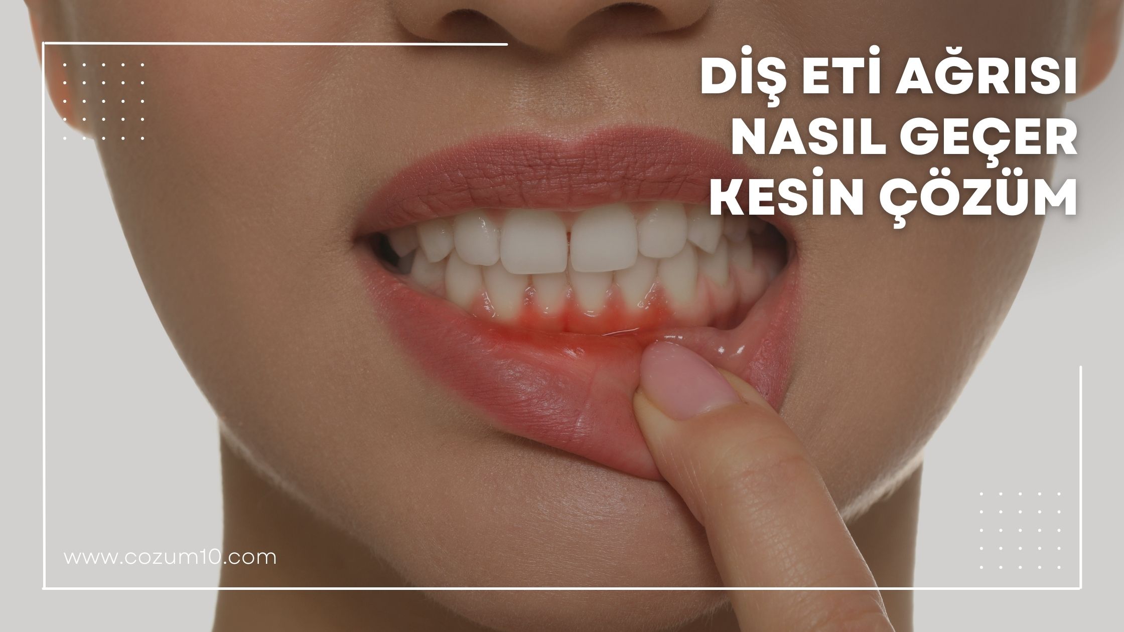Diş Eti Ağrısı Nasıl Geçer Kesin Çözüm