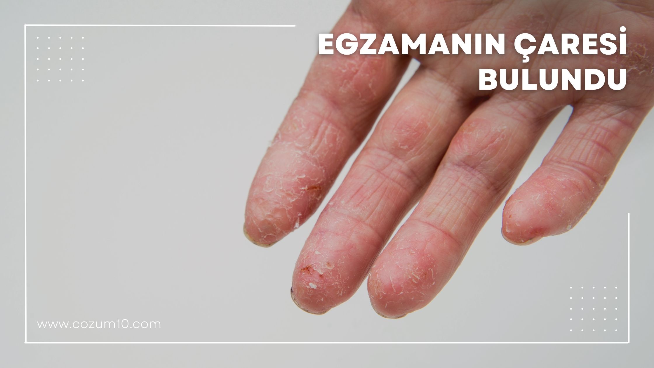 Egzamanın Çaresi Bulundu