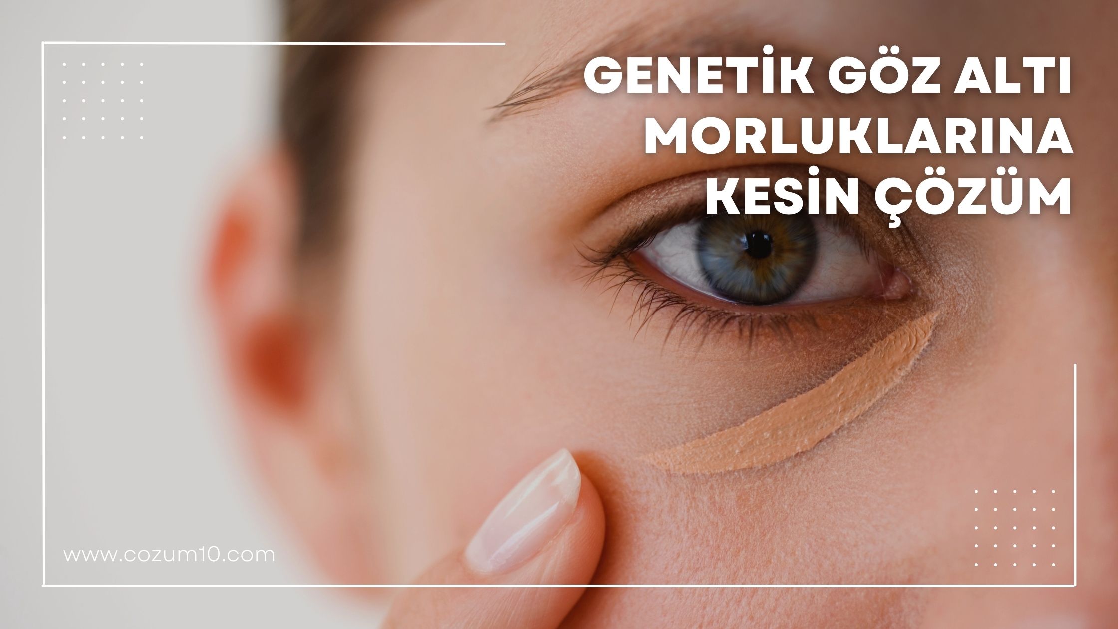 Genetik Göz Altı Morluklarına Kesin Çözüm