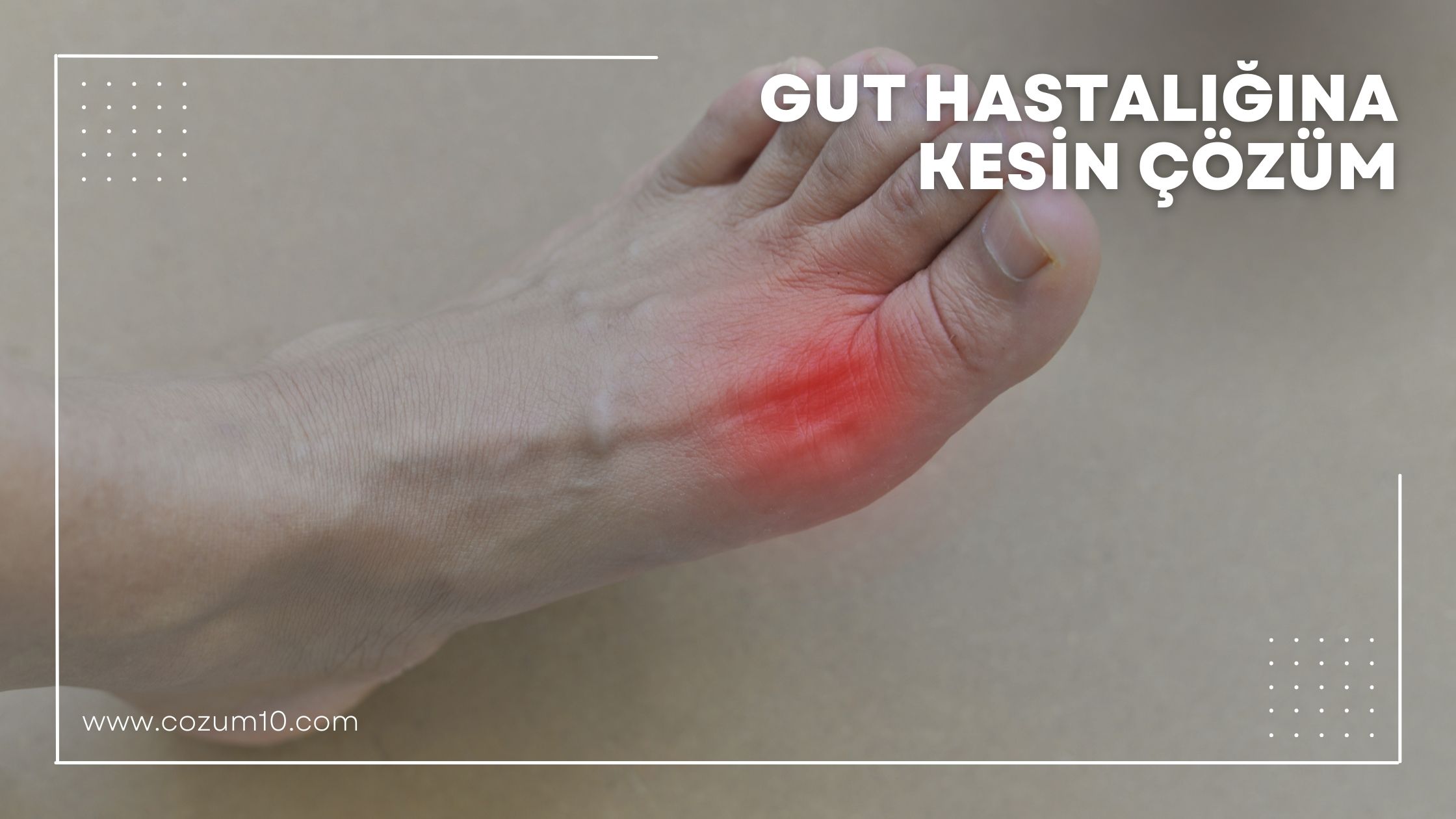 Gut Hastalığına Kesin Çözüm