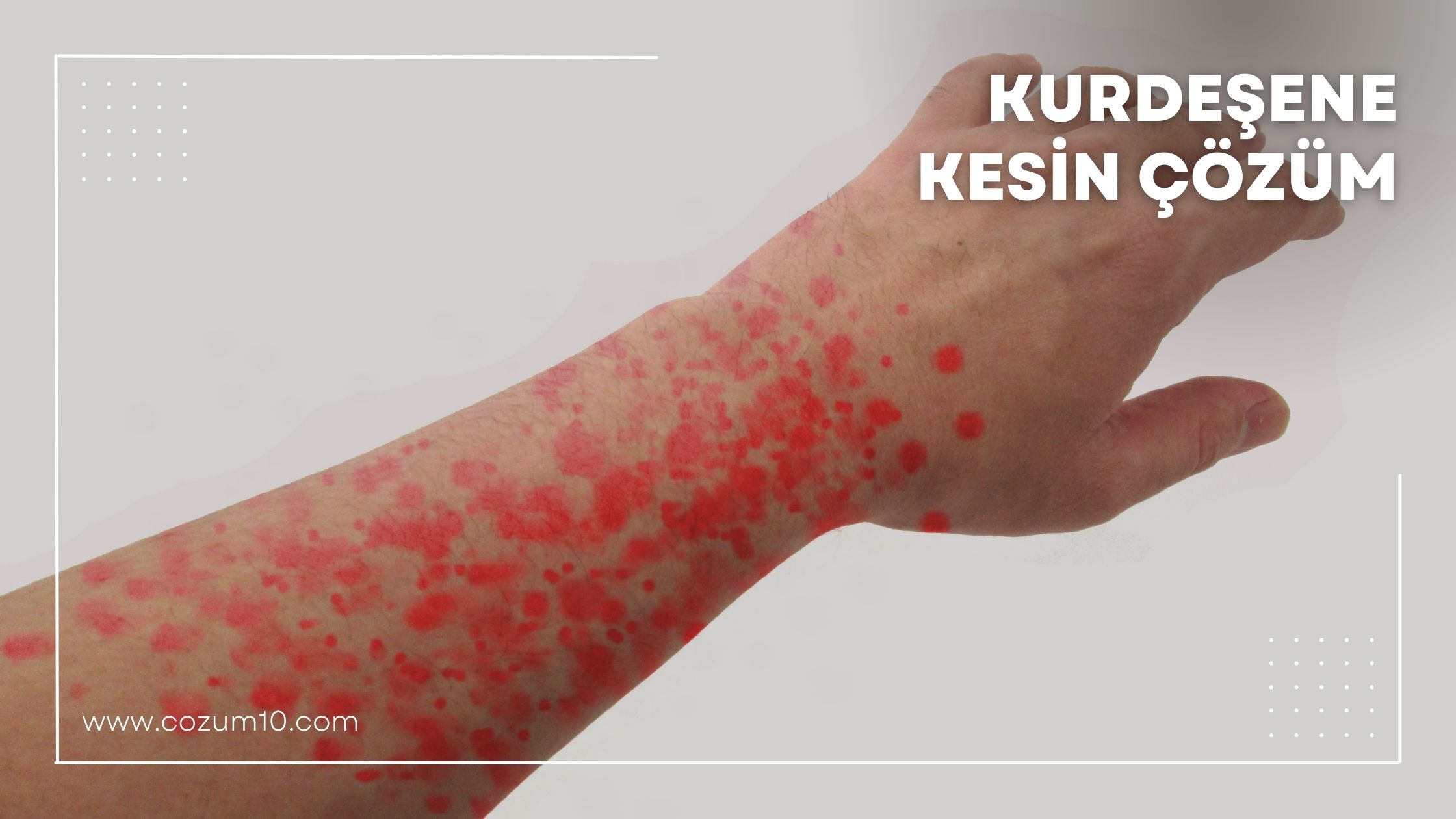 Kurdeşene Kesin Çözüm
