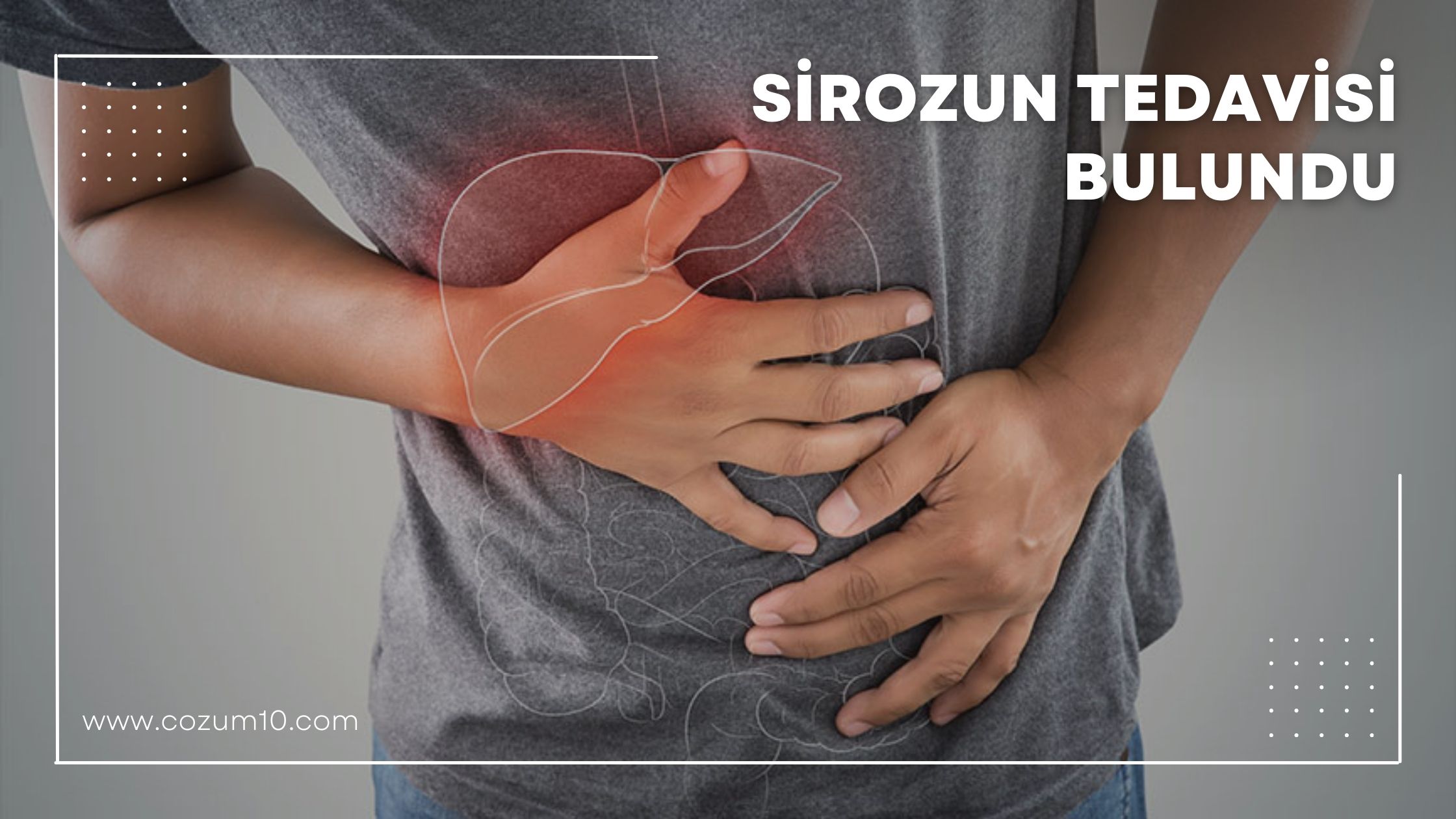 Sirozun Tedavisi Bulundu