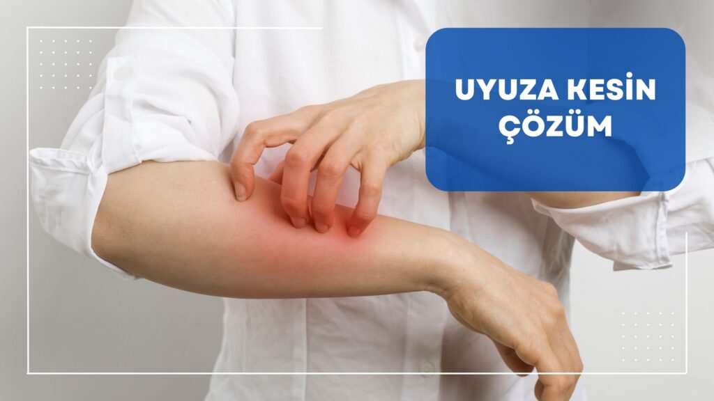 Uyuza Kesin Çözüm