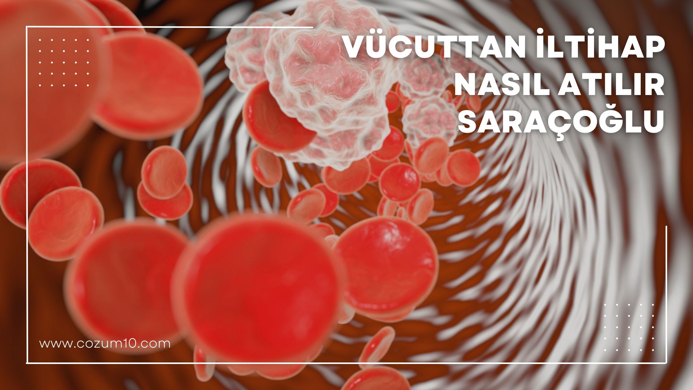 Vücuttan İltihap Nasıl Atılır Saraçoğlu